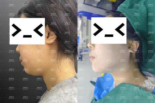 无锡可琳雅医疗整形医院价格表