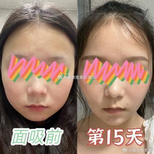 重庆妮杨丝医疗美容诊所怎么样