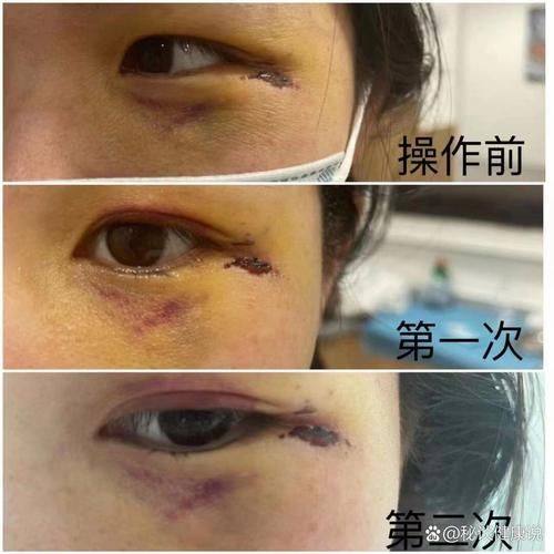 重庆妮杨丝医疗美容诊所预约挂号方式