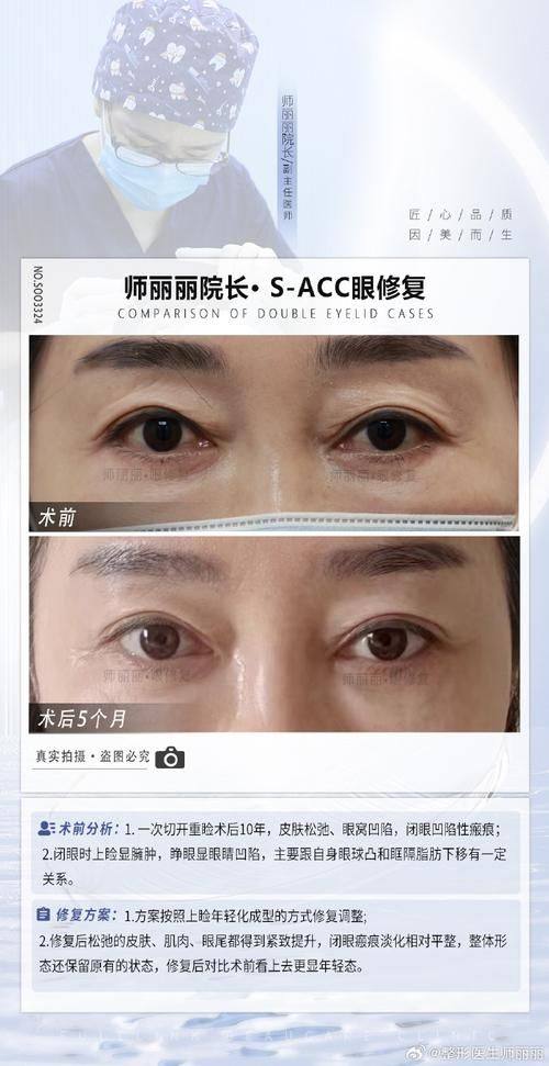 广州泛美泓涵医疗美容门诊部医生名单及擅长领域：