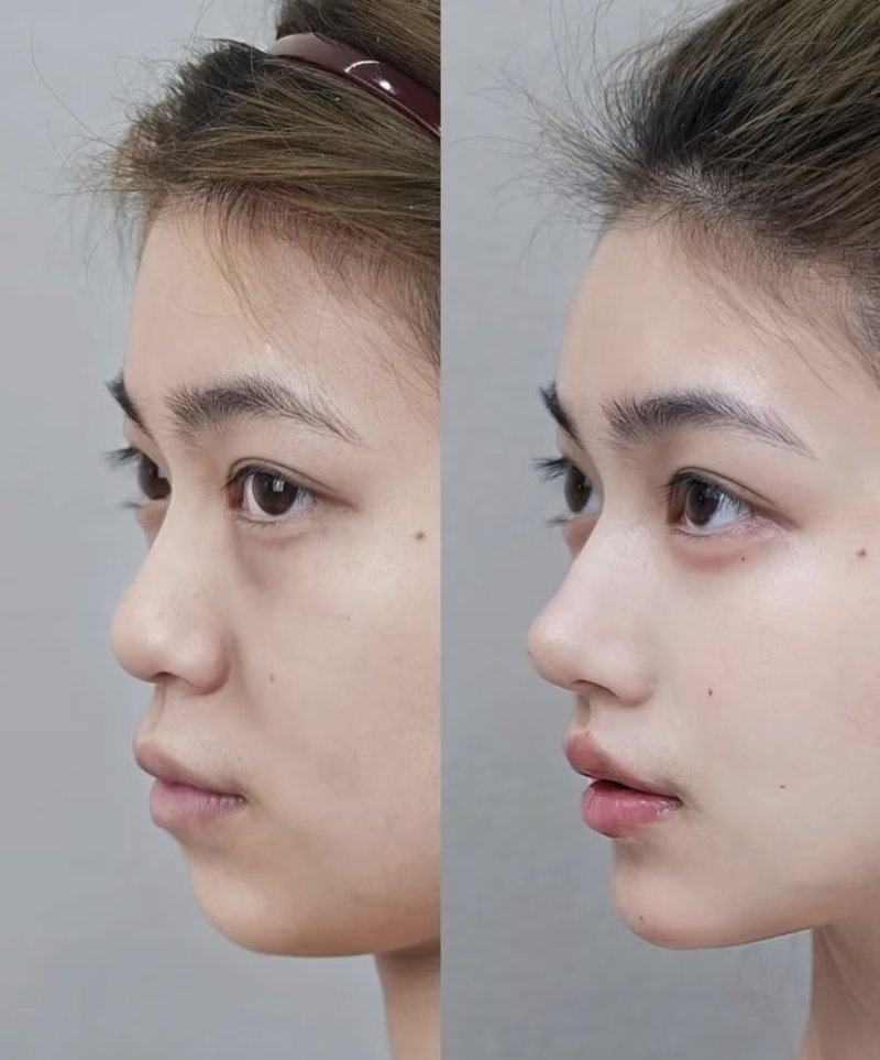 陈艾医生技术优势: