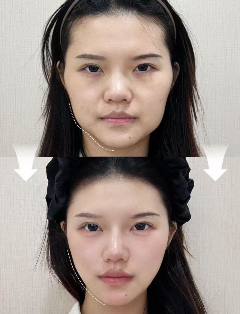 四、植发手术的禁忌症人群