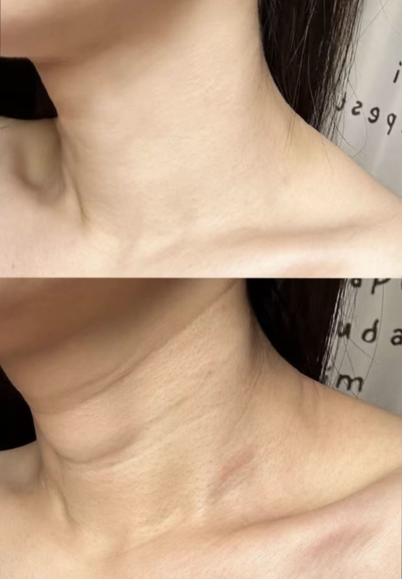 陈艾医生擅长领域: