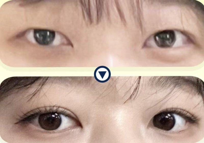 湖南株洲星薇美医疗美容门诊部价格表