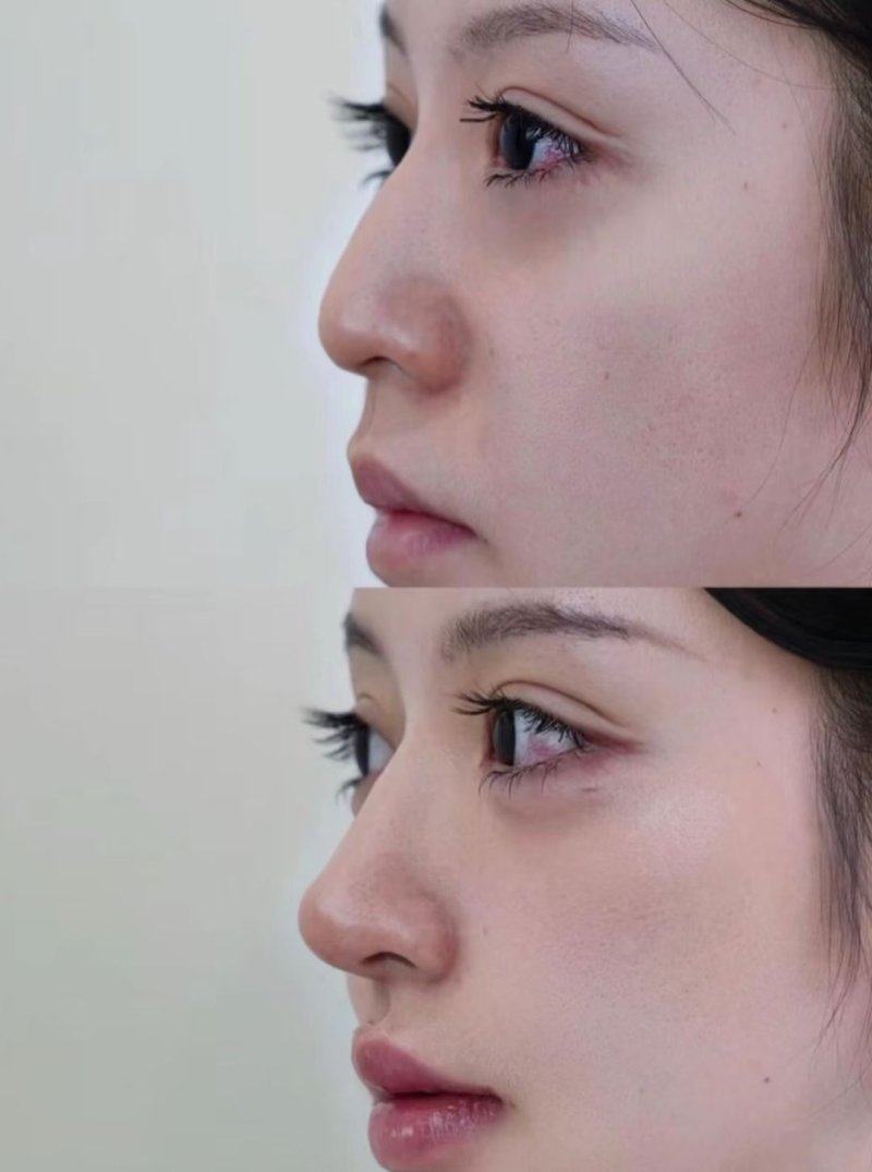 湖南株洲星薇美医疗美容门诊部擅长项目: