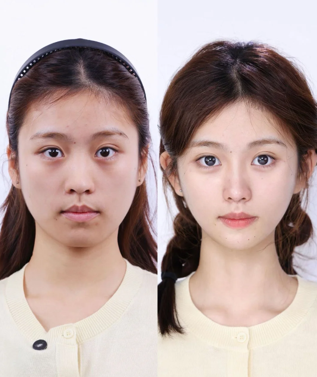 青岛瑧妍美医疗美容医院田莉：平衡私密整形的安心与美学需求