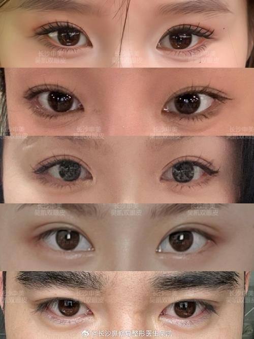 李明红医生技术优势