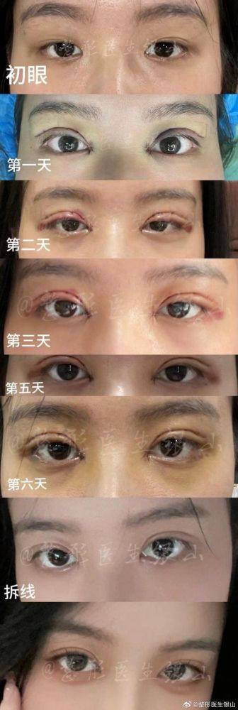 沈阳杨庆峰医疗美容诊所擅长项目