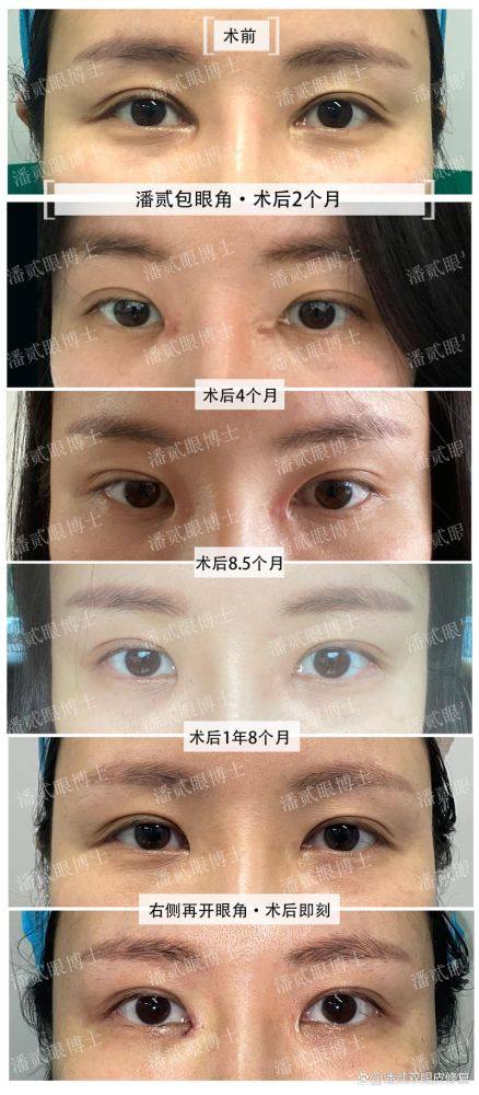 沈阳铂木整形医院口碑评价