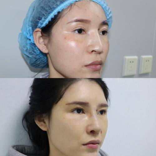 李明红医生怎么预约