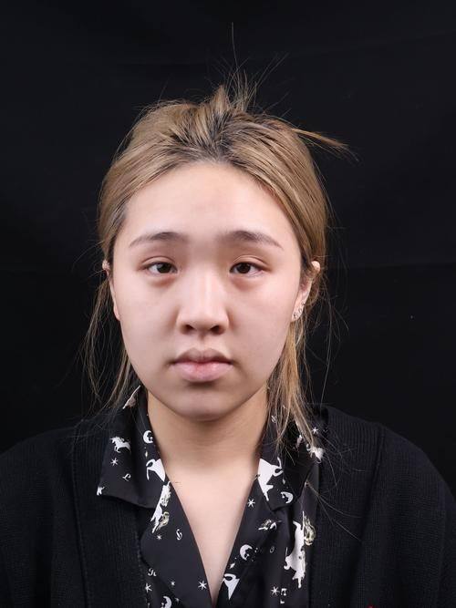 广州美菲斯整形医院预约挂号方式：