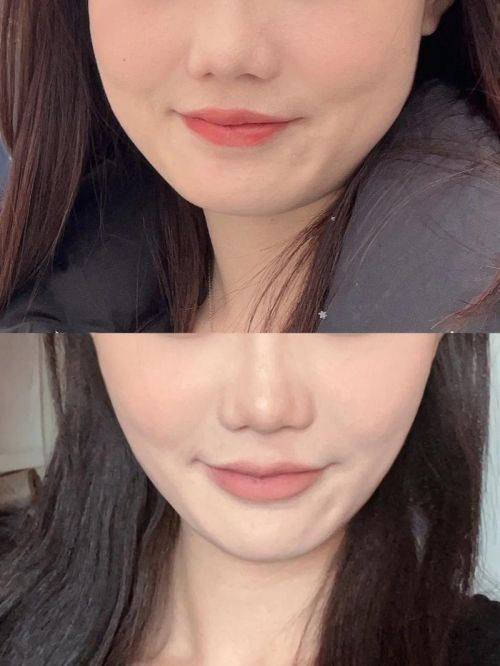 韩国姜韩皮肤科医院预约挂号方式：