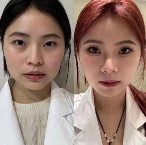 韩国姜韩皮肤科医院价格表：