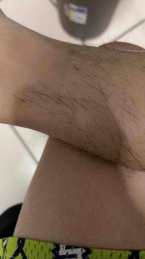 韩国姜韩皮肤科医院口碑评价：