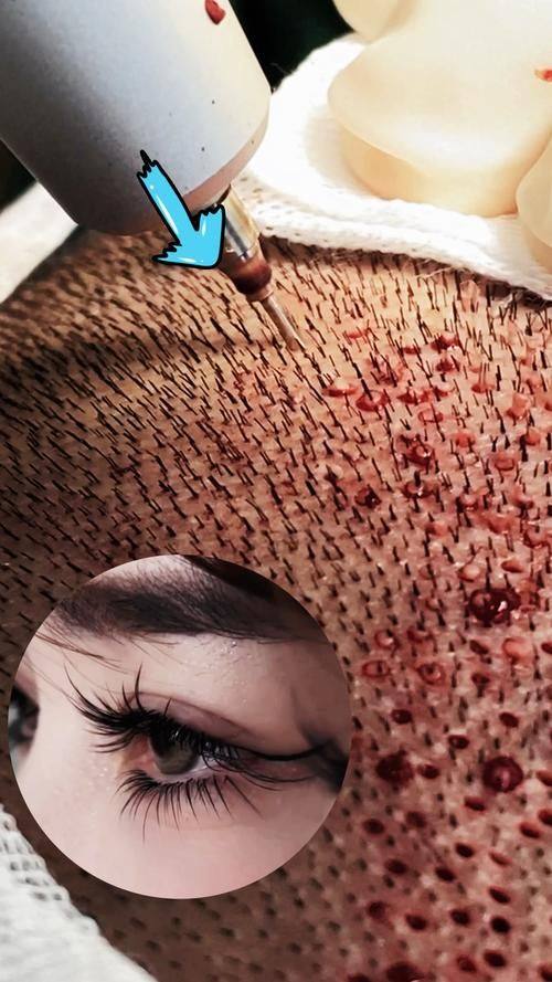 西安雍禾医疗美容诊所预约挂号方式：