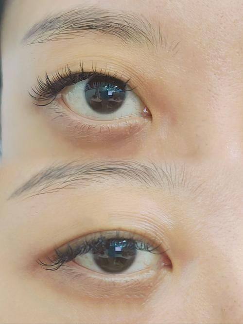 张东勤医生口碑评价