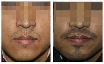 西安雍禾医疗美容诊所擅长项目：