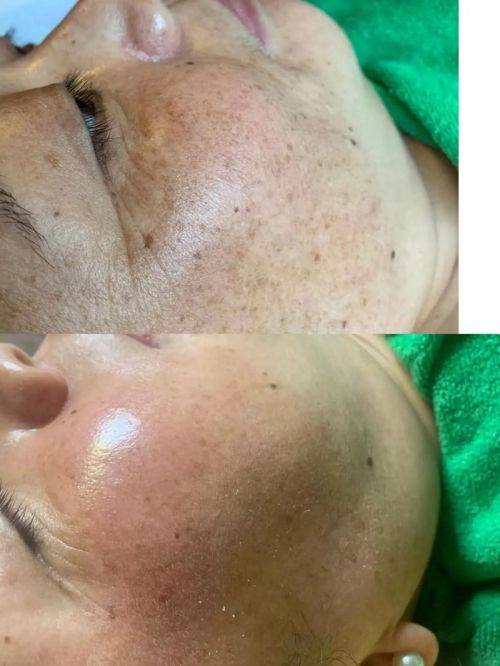 赵文广医生口碑评价