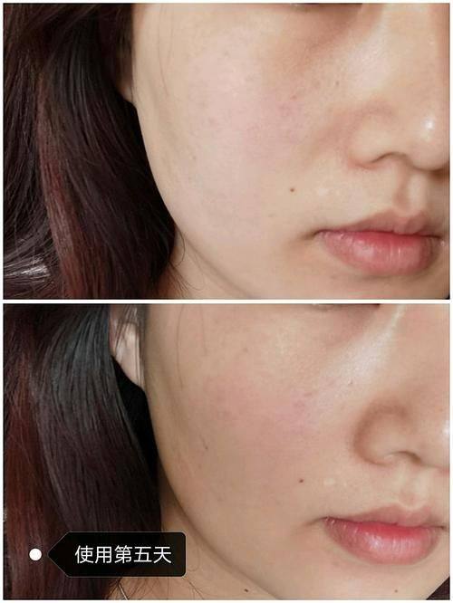 广州美菲斯整形医院价格表：