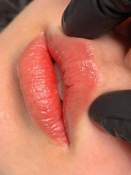 济南熙美人医疗美容门诊部擅长项目：