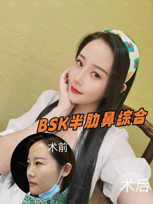 连云港亿大整形医院擅长项目：