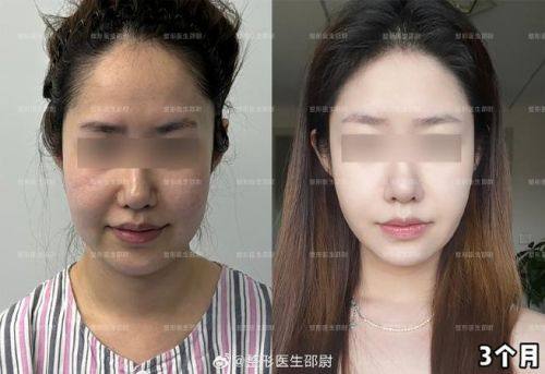 连云港亿大整形医院预约挂号方式：