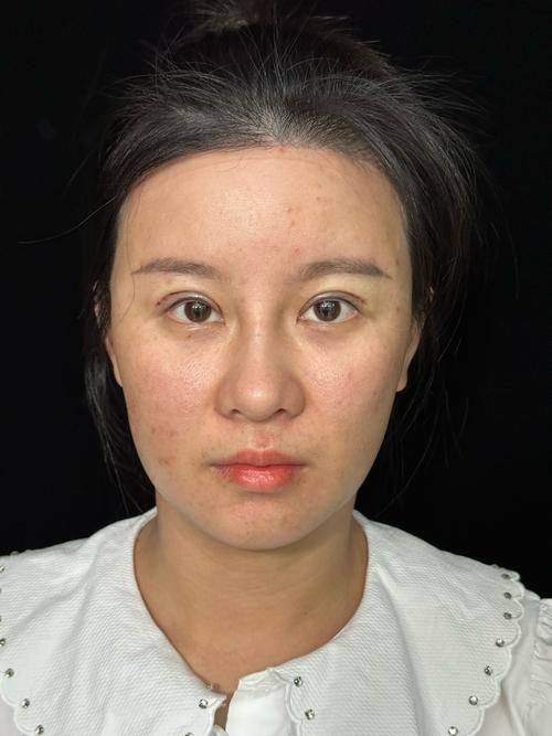 沈阳杨庆峰医疗美容诊所预约挂号方式