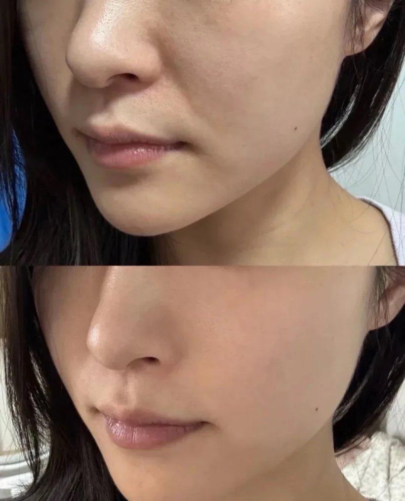 连云港亿大整形医院口碑评价：