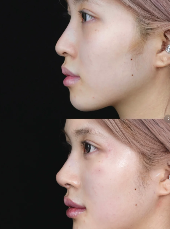 五、治疗时机：抓住修复关键期