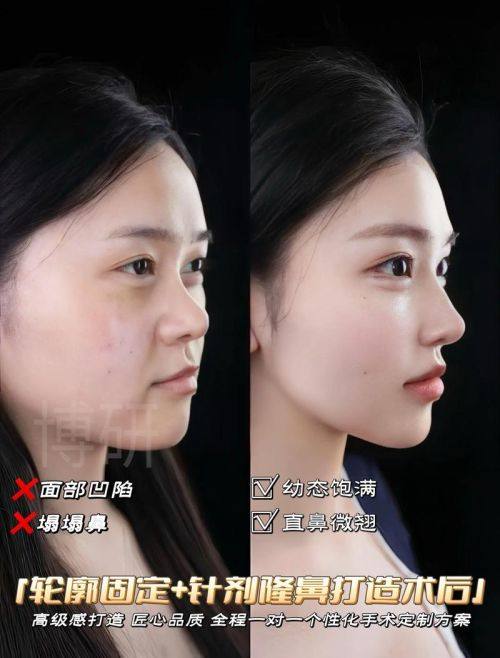 西安未央漾慕整形医院擅长项目：