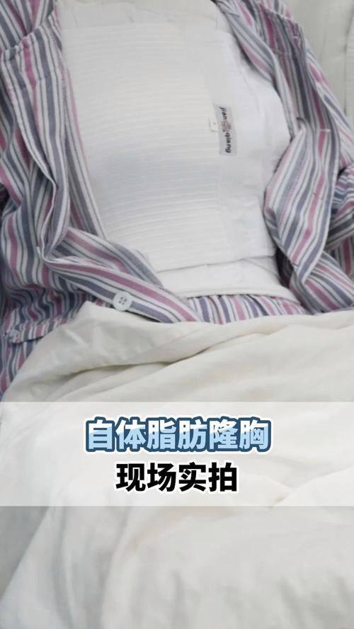 韩国snow整形外科价格表：