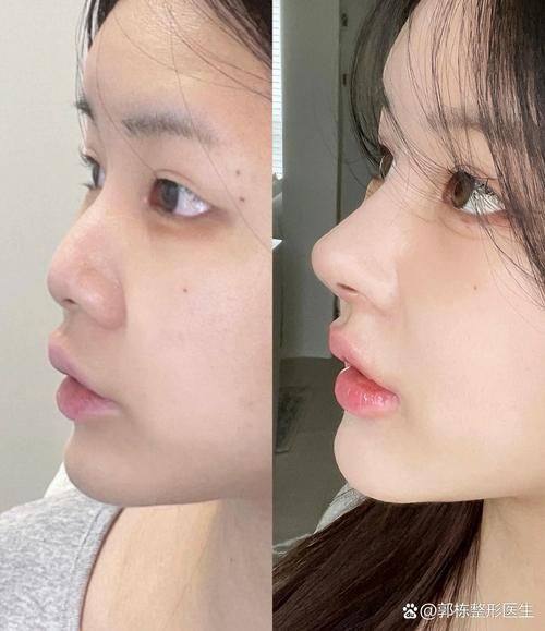 韩国博士75整形外科擅长项目