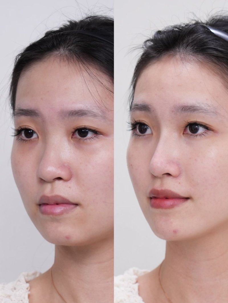 海口鸿一倾研整形医院口碑评价：