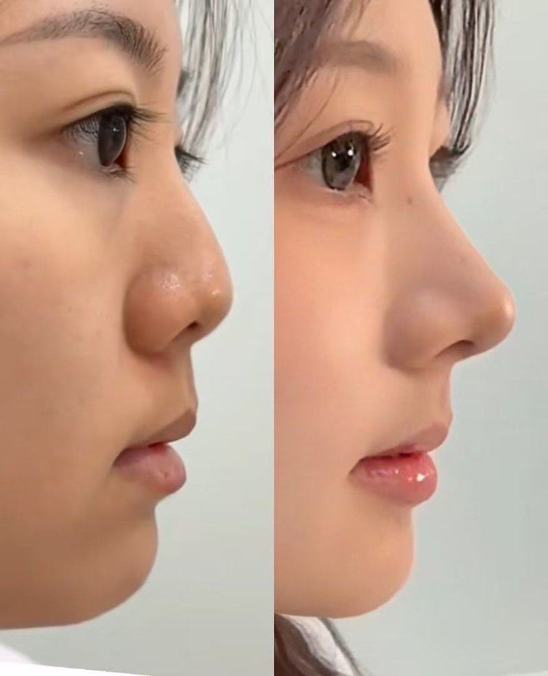 永康市美莱医疗美容门诊部怎么样？