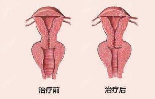 詹繁荣医生口碑评价