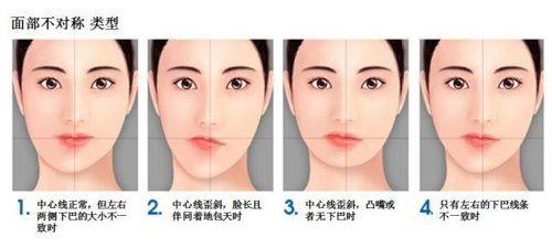 三、真实患者体验实例解析