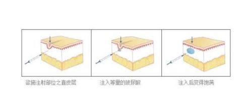 二、热门医生技术与口碑测评