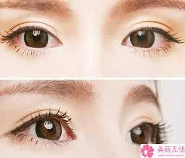 石家庄雍禾植发美容医院地址电话及营业时间