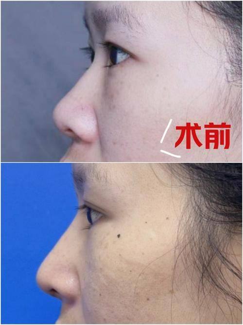 深圳康盈整形美容医院擅长项目：