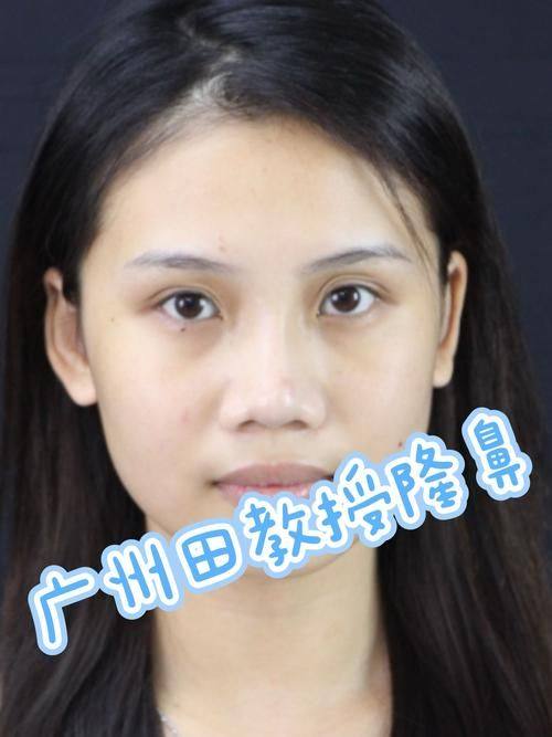 王金花医生擅长领域