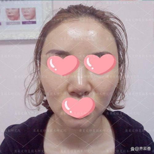 南京优外里美整形医院预约挂号方式