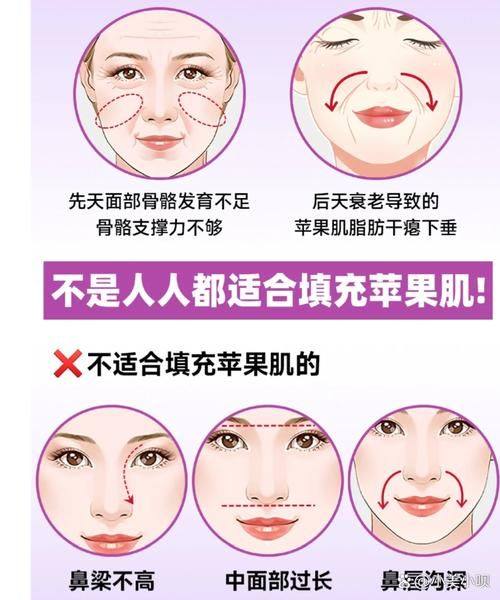 南京优外里美整形医院价格表