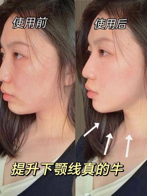 南京优外里美整形医院地址电话及营业时间