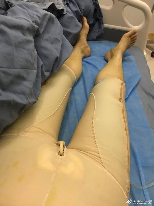 宁夏银川崔大夫医疗美容价格表