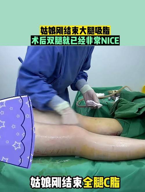 深圳康盈整形美容医院价格表：