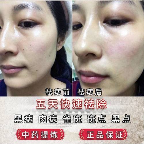 山东临沂星铄（鼎颜）医疗美容医院预约挂号方式：