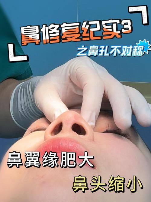 山东临沂星铄（鼎颜）医疗美容医院擅长项目：