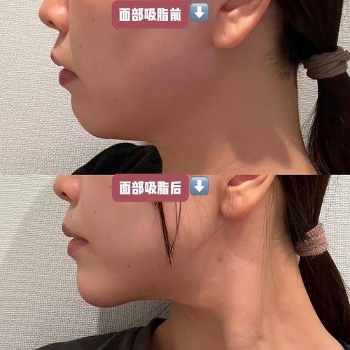 山东临沂星铄（鼎颜）医疗美容医院口碑评价：