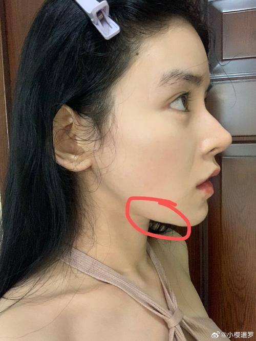 南京优外里美整形医院口碑评价