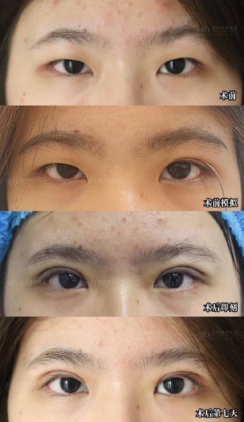 南京优外里美整形医院医生名单及擅长领域：